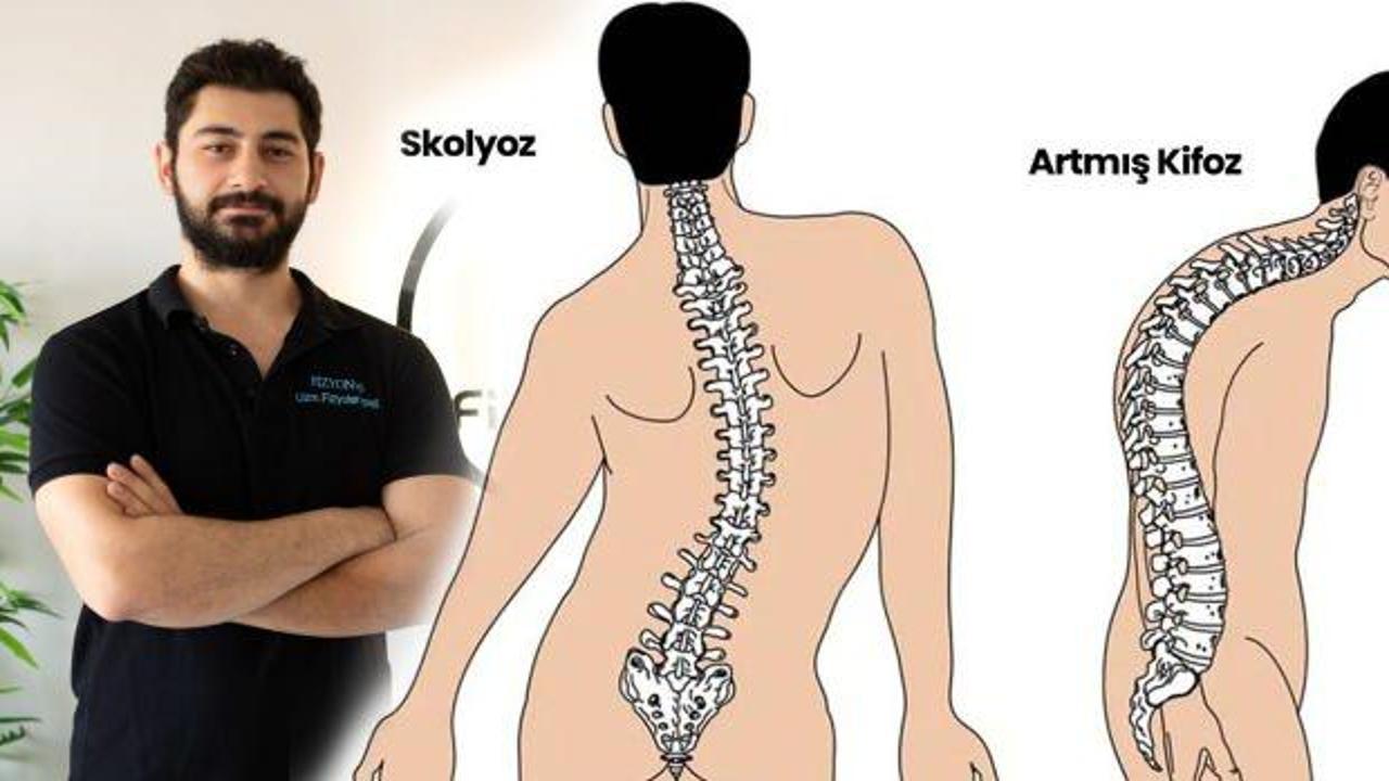 Uzman Fizyoterapist Muhammed Enes Arıca Schroth Terapisi ile ilgili konuştu!