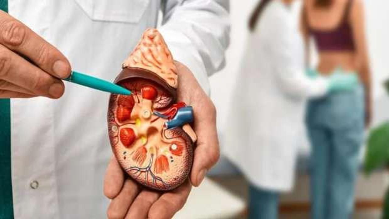 Uzmanlardan uyarı geldi: Bu besinler böbrek taşı oluşumunu destekliyor!