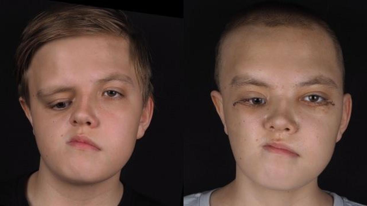 Kazakistanlı 14 yaşındaki Nikita şifayı Pendik’te buldu